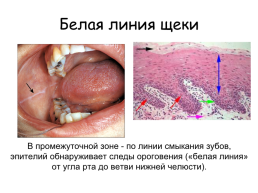 Органы полости рта, слайд 12