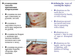 Травматология (общие вопросы), слайд 10