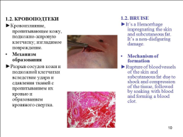 Травматология (общие вопросы), слайд 11