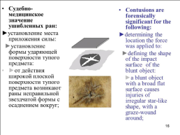 Травматология (общие вопросы), слайд 17