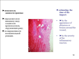 Травматология (общие вопросы), слайд 20