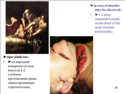 Травматология (общие вопросы), слайд 36