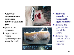 Травматология (общие вопросы), слайд 41