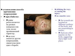 Травматология (общие вопросы), слайд 45