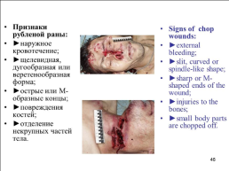 Травматология (общие вопросы), слайд 47