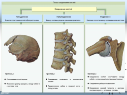 Тема урока «Форма, строение, состав и свойства костей, рост костей. Типы соединения костей», слайд 13