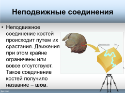 Тема урока «Форма, строение, состав и свойства костей, рост костей. Типы соединения костей», слайд 14