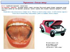 Артикуляционная гимнастика, слайд 29