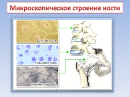 Опорно-двигательная система - Строение, состав и свойства костей, слайд 22