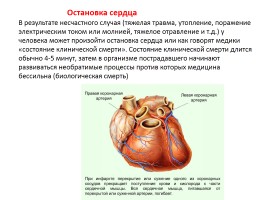 Первая медицинская помощь при остановке сердца 11 класс, слайд 2
