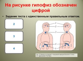 Мультимедийный тест «Железы внутренней секреции», слайд 5