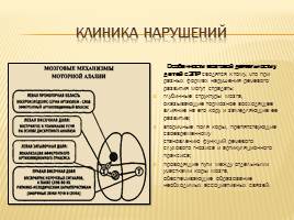 Дифференциальная диагностика алалии и задержки психического развития, слайд 3