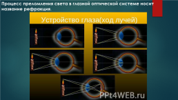 Линзы. Глаз как оптическая система. Оптические приборы, слайд 30