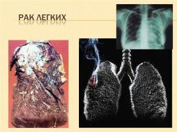 Курение или здоровье, слайд 7