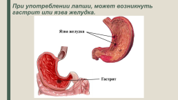 Доширак - еда быстрого приготовления, слайд 8