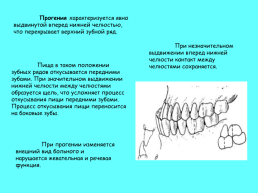 Анатомическое строение зубов человека, слайд 37