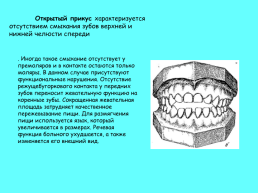 Анатомическое строение зубов человека, слайд 39