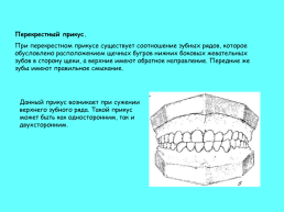 Анатомическое строение зубов человека, слайд 40