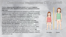 Значение соматотропного гормона гипофиза в разви-тии организма, слайд 8