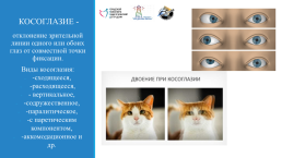 Развитие зрительно-пространственного восприятия у детей с нарушением зрения (амблиопия и косоглазие), слайд 2