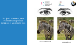 Развитие зрительно-пространственного восприятия у детей с нарушением зрения (амблиопия и косоглазие), слайд 4
