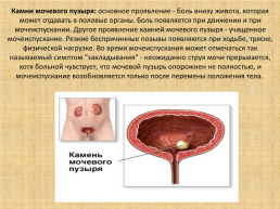 Заболевания почек, слайд 9