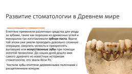 История развития стоматологии, слайд 6