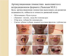 Инновационные технологии в логопедической работе, слайд 8