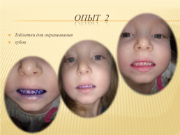 Влияет ли зубная паста на прочность зубов?, слайд 10