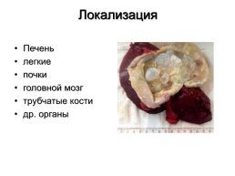 Медицинская гельминтология и арахноэнтомология, слайд 31