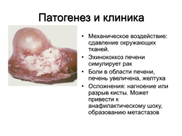 Медицинская гельминтология и арахноэнтомология, слайд 32